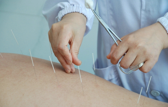 针灸的注意事项 皮肤感染不予针刺。