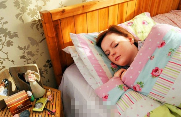 英国女子患睡美人症 详解睡美人症的特征