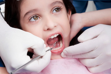 四环素牙的临床症状及治疗方法