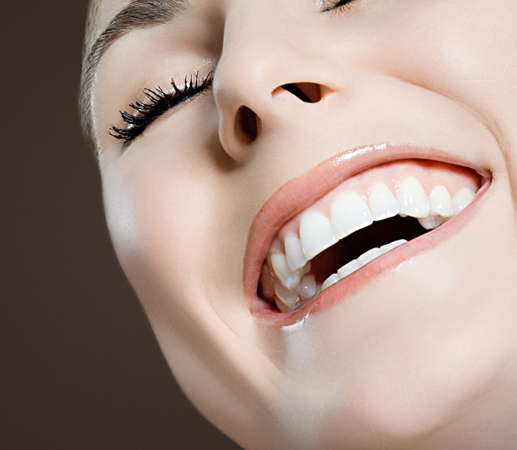 四环素牙通常采取哪些方式美白