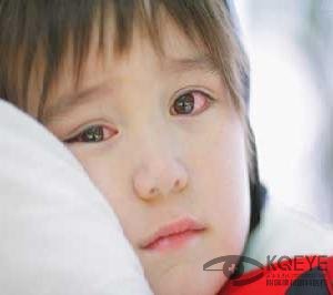 红眼病的症状与预防方法