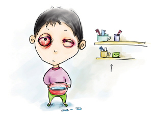 红眼病的预防常识及注意事项详细介绍