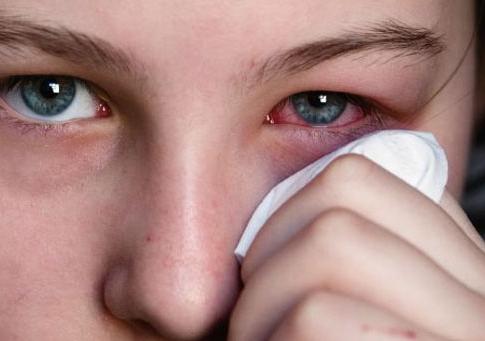 夏季红眼病的传播途径 红眼病的预防措施