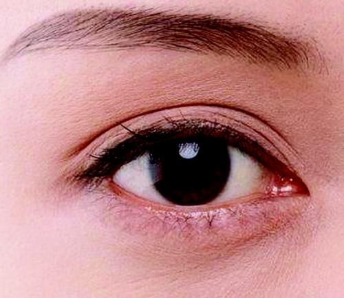 红眼病是怎么传染的 如何预防传染红眼病
