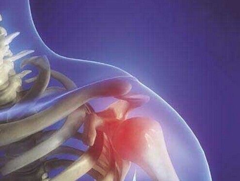 肩周炎的四大典型表现 肩关节活动受限