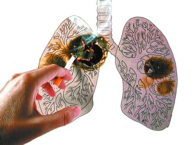 肺癌是气出来的病 肺癌的治疗方法
