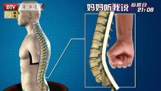 腰椎变直会造成骨盆过度前倾，如果骨盆出现了前倾就会导致重心前移