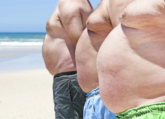 易胖体质能变成易瘦体质吗 易胖体质是如何形成的