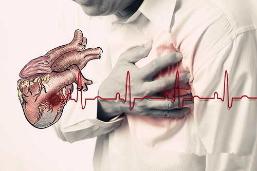 心脏早搏怎么办 诱发心脏早搏的原因