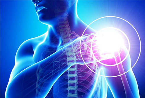 肩周炎怎么治 4个小动作轻松解决肩周炎