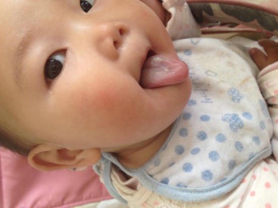 婴儿积食有什么表现 宝宝积食吃什么水果好