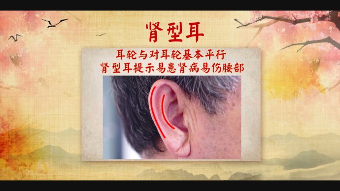 2018年5月9日播出《知耳型辨健康——肾型耳》