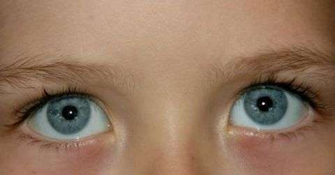 青光眼最佳治疗方法有哪些