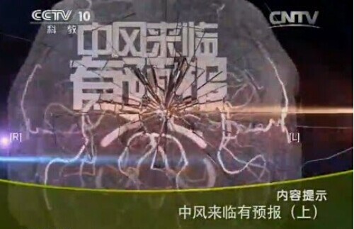 zfllyyb CCTV10健康之路视频20140911中风来临有预报1 姜卫剑