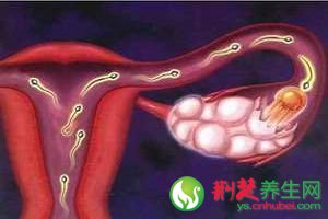 输卵管堵塞的防治方法及发病原因