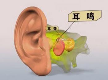听力下降患者日常生活的注意事项