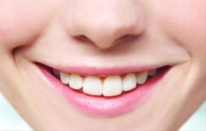 四环素牙是由什么原因引起的？
