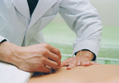 针灸的治疗方法 通经络治疗乳腺增生(2)