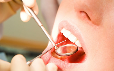 如何预防牙病 得了牙病又该如何治疗