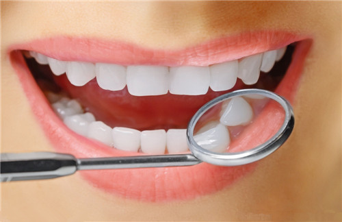 四环素牙的症状表现 牙齿黄了怎么变白