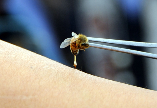 蜂疗的副作用 选择蜂疗要慎重