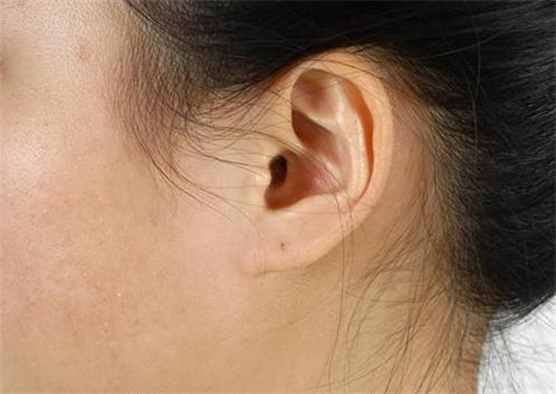 耳鸣的早期症状 这些原因也会引起耳鸣