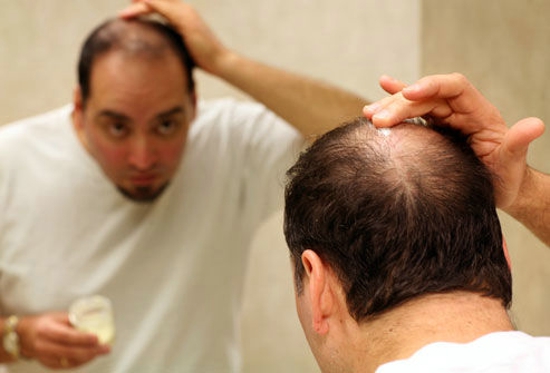 男人产生衰老的标志 视力减弱头发稀疏