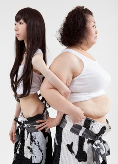 肥胖会引起“三高症”吗  健康减肥的五大方法